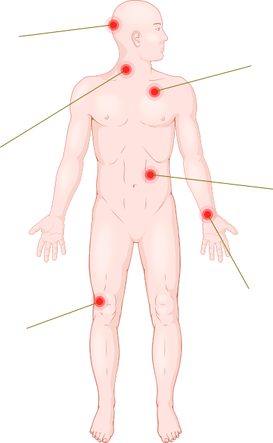 Pain Areas Image